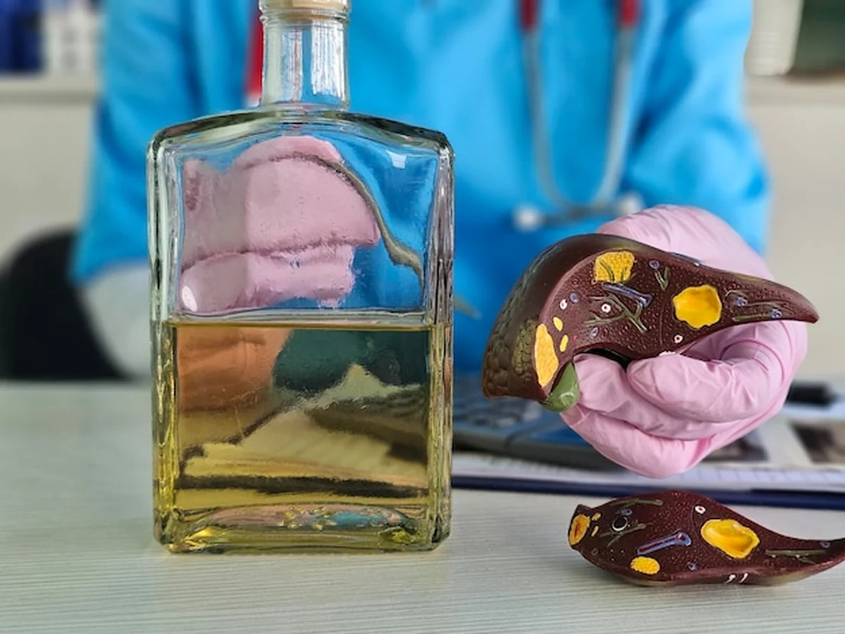 Uszkodzenie wątroby spowodowane alkoholem i marskość wątroby