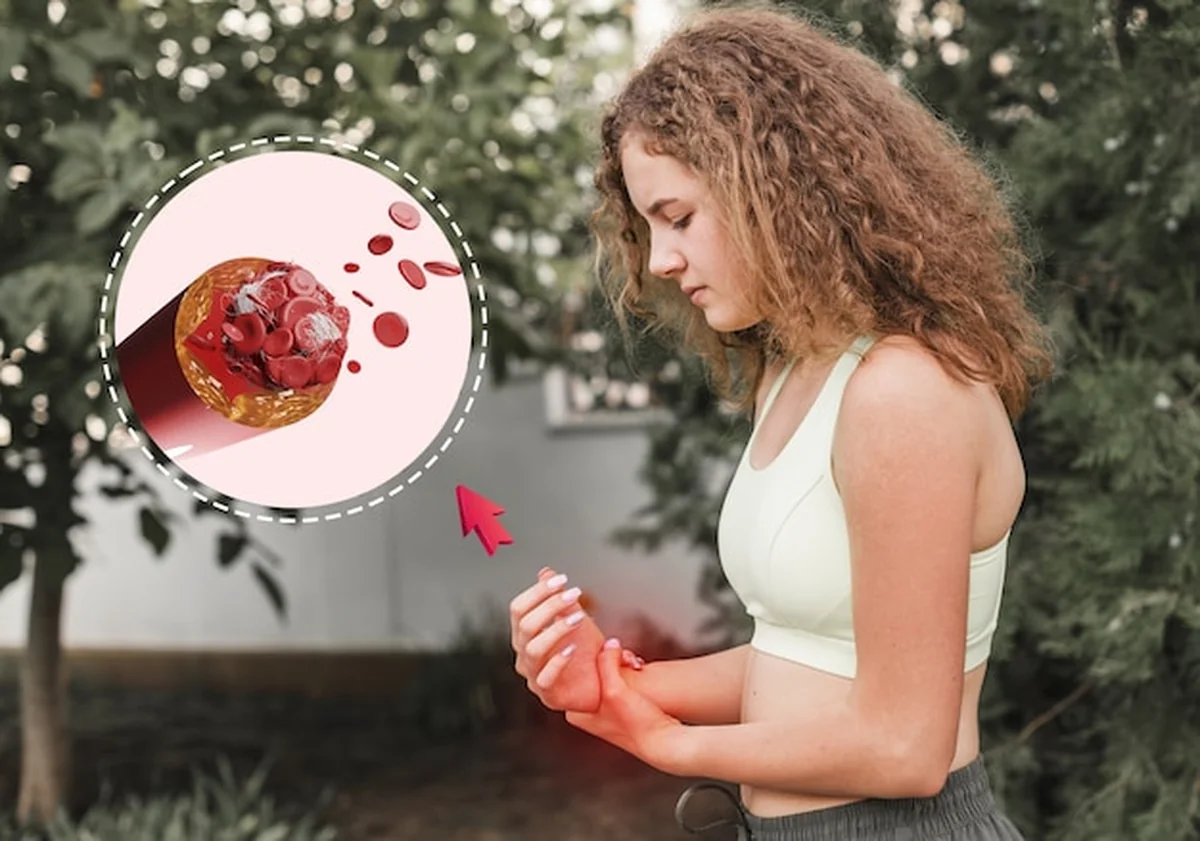 Collage osoby z zakrzepami krwi